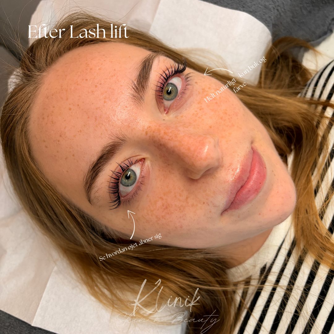 Lash Lift resultat